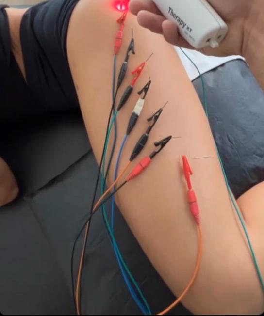 A person with wires attached to their leg
Description automatically generated